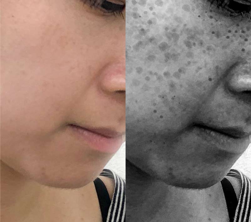 シミ シワの悩み解決 世界のコシノが考えた紫外線ケアの最新技術 医薬部外品の美白コスメが予想以上にスゴかった Macherie